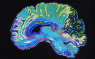 New Insights into How the Teenage Brain Develops