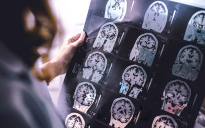 Brain Scans Can Predict Your Political Affiliation