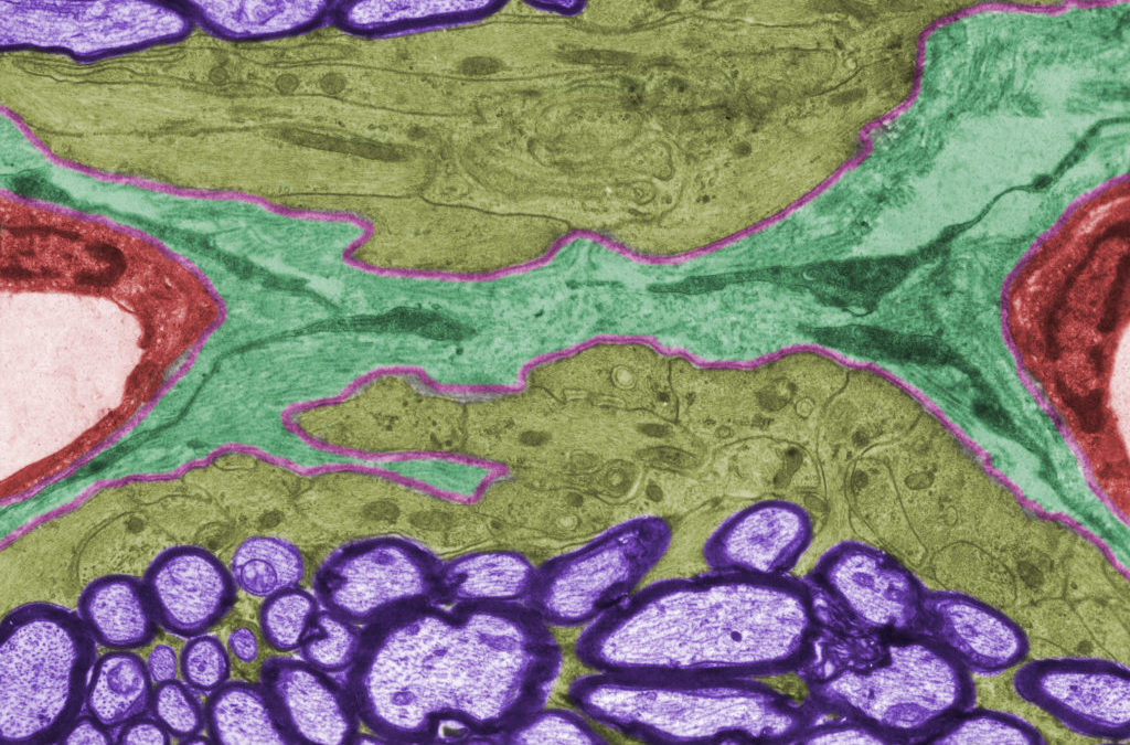 How Your Brain Eats Itself – To Improve Memory